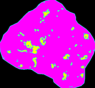 CD68(巨噬细胞)面积:998 μm2