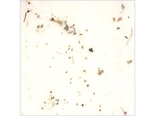 计数前:环状照明(50×)