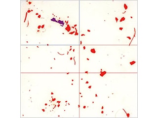 计数后:环状照明(50×)
