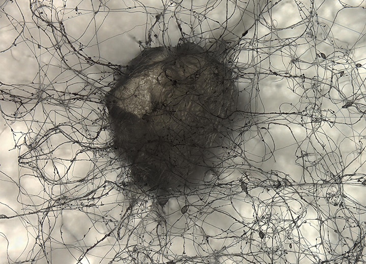 透过照明(100×)